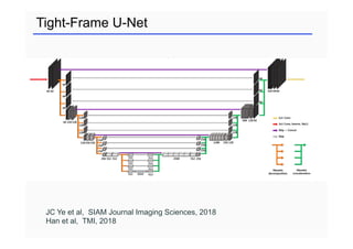 Tight-Frame U-Net
JC Ye et al, SIAM Journal Imaging Sciences, 2018
Han et al, TMI, 2018
 