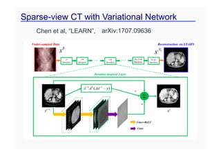 Sparse-view CT with Variational Network
Chen et al, “LEARN”, arXiv:1707.09636
 