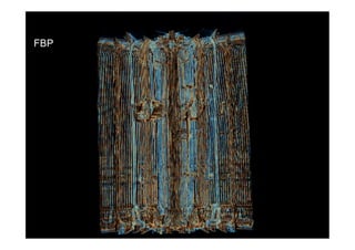 FBP
 