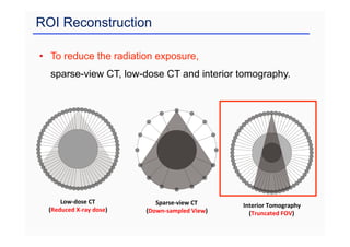ROI Reconstruction
• To reduce the radiation exposure,
sparse-view CT, low-dose CT and interior tomography.
Sparse-view CT
(Down-sampled View)
Low-dose CT
(Reduced X-ray dose)
Interior Tomography
(Truncated FOV)
 