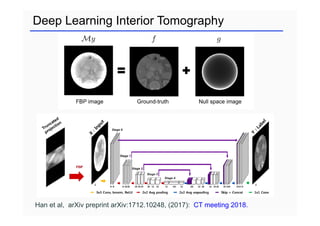 Deep Learning Interior Tomography
Han et al, arXiv preprint arXiv:1712.10248, (2017): CT meeting 2018.
 