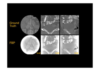 Ground
Truth
FBP
 