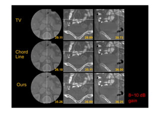 TV
Chord
Line
Ours
8~10 dB
gain
 