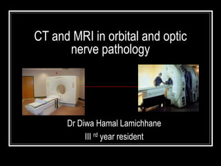 CT and MRI in orbital and optic
nerve pathology
Dr Diwa Hamal Lamichhane
III rd year resident
 