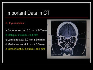 CT and MRI | PPTX