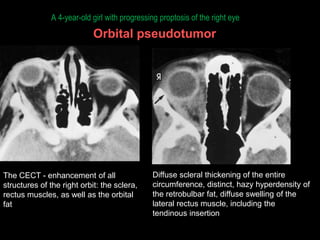 CT and MRI | PPTX