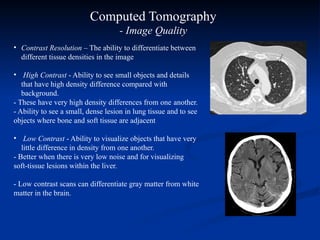 Computed Tomography BOOk: physical processes of medical imaging | PPTX