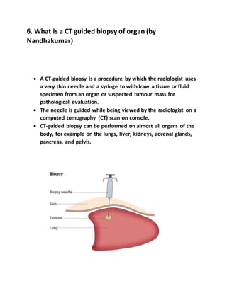 6. What is a CT guided biopsy of organ (by
Nandhakumar)
 A CT-guided biopsy is a procedure by which the radiologist uses
a very thin needle and a syringe to withdraw a tissue or fluid
specimen from an organ or suspected tumour mass for
pathological evaluation.
 The needle is guided while being viewed by the radiologist on a
computed tomography (CT) scan on console.
 CT-guided biopsy can be performed on almost all organs of the
body, for example on the lungs, liver, kidneys, adrenal glands,
pancreas, and pelvis.
 
