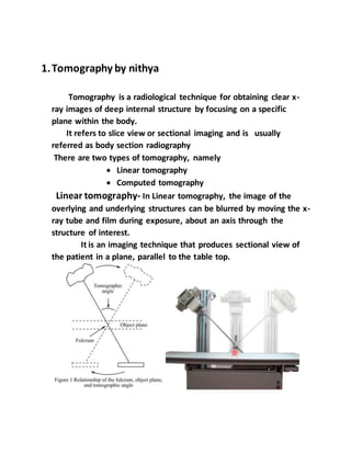1.Tomography by nithya
Tomography is a radiological technique for obtaining clear x-
ray images of deep internal structure by focusing on a specific
plane within the body.
It refers to slice view or sectional imaging and is usually
referred as body section radiography
There are two types of tomography, namely
 Linear tomography
 Computed tomography
Linear tomography- In Linear tomography, the image of the
overlying and underlying structures can be blurred by moving the x-
ray tube and film during exposure, about an axis through the
structure of interest.
It is an imaging technique that produces sectional view of
the patient in a plane, parallel to the table top.
 