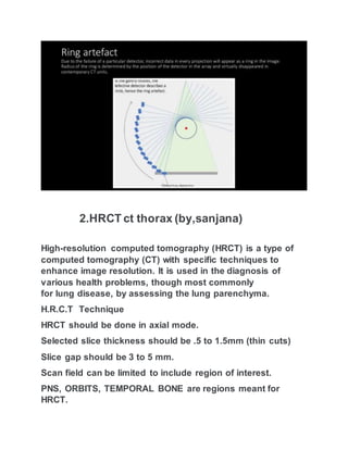 2.HRCT ct thorax (by,sanjana)
High-resolution computed tomography (HRCT) is a type of
computed tomography (CT) with specific techniques to
enhance image resolution. It is used in the diagnosis of
various health problems, though most commonly
for lung disease, by assessing the lung parenchyma.
H.R.C.T Technique
HRCT should be done in axial mode.
Selected slice thickness should be .5 to 1.5mm (thin cuts)
Slice gap should be 3 to 5 mm.
Scan field can be limited to include region of interest.
PNS, ORBITS, TEMPORAL BONE are regions meant for
HRCT.
 