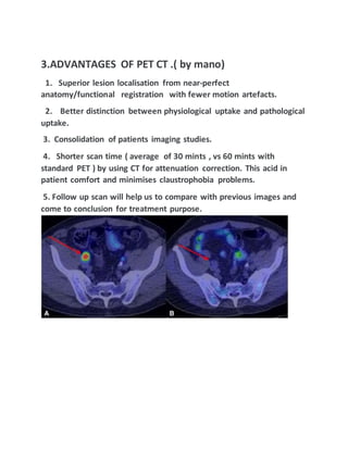 3.ADVANTAGES OF PET CT .( by mano)
1. Superior lesion localisation from near-perfect
anatomy/functional registration with fewer motion artefacts.
2. Better distinction between physiological uptake and pathological
uptake.
3. Consolidation of patients imaging studies.
4. Shorter scan time ( average of 30 mints , vs 60 mints with
standard PET ) by using CT for attenuation correction. This acid in
patient comfort and minimises claustrophobia problems.
5. Follow up scan will help us to compare with previous images and
come to conclusion for treatment purpose.
 