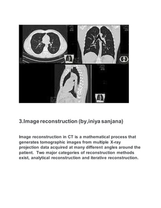 3.Imagereconstruction (by,iniya sanjana)
Image reconstruction in CT is a mathematical process that
generates tomographic images from multiple X-ray
projection data acquired at many different angles around the
patient. Two major categories of reconstruction methods
exist, analytical reconstruction and iterative reconstruction.
 