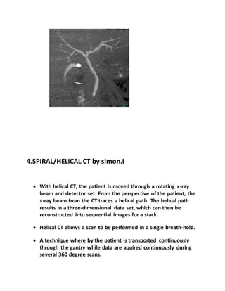 4.SPIRAL/HELICAL CT by simon.I
 With helical CT, the patient is moved through a rotating x-ray
beam and detector set. From the perspective of the patient, the
x-ray beam from the CT traces a helical path. The helical path
results in a three-dimensional data set, which can then be
reconstructed into sequential images for a stack.
 Helical CT allows a scan to be performed in a single breath-hold.
 A technique where by the patient is transported continuously
through the gantry while data are aquired continuously during
several 360 degree scans.
 