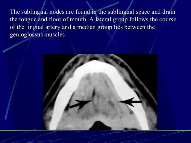 Ct Anatomy Of The Neck Spaces