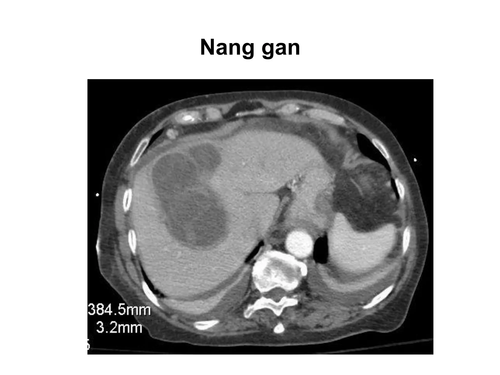 CT NGỰC - CLS HÈ 2019 (1).pdf