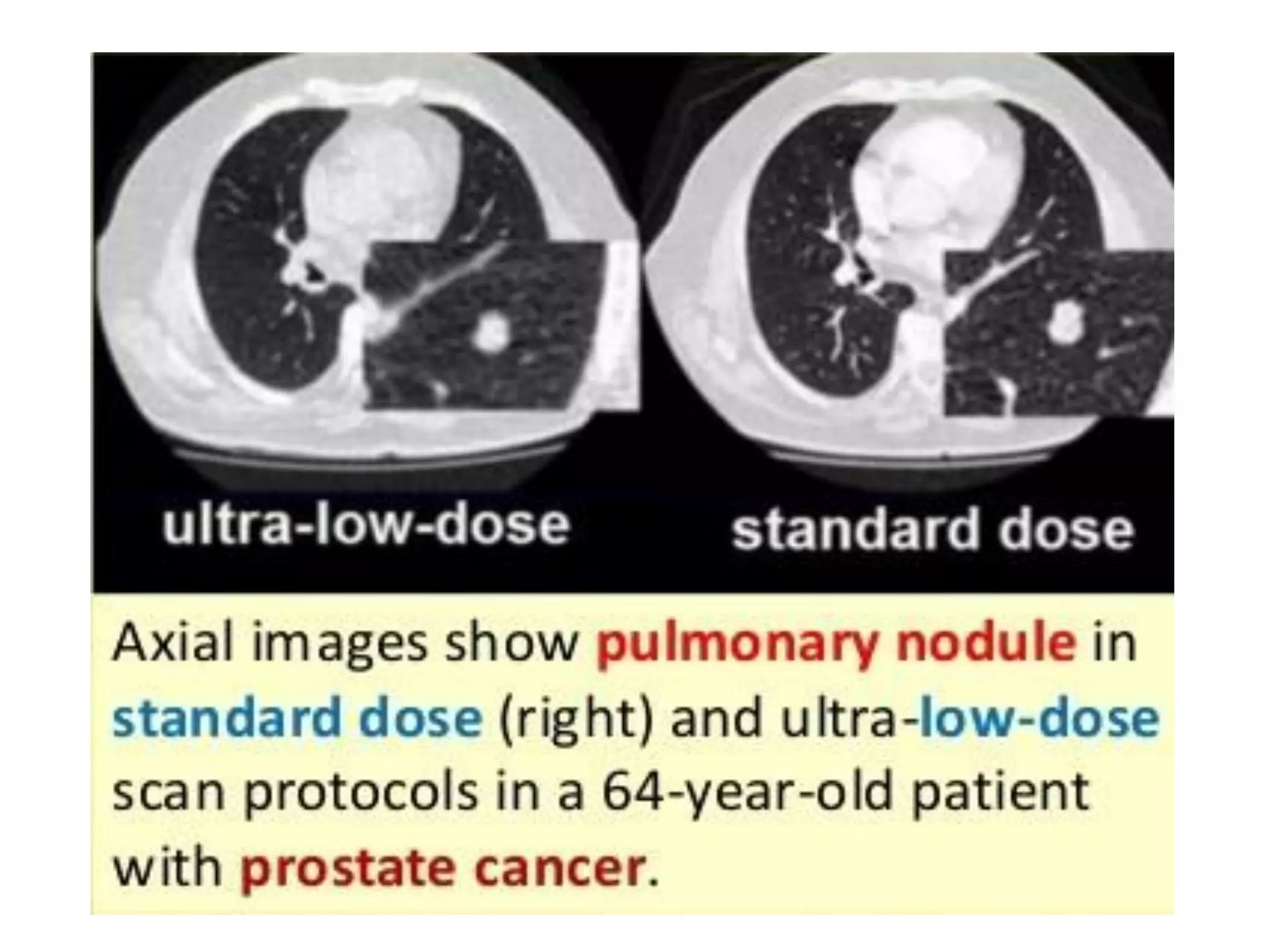 CT NGỰC - CLS HÈ 2019 (1).pdf