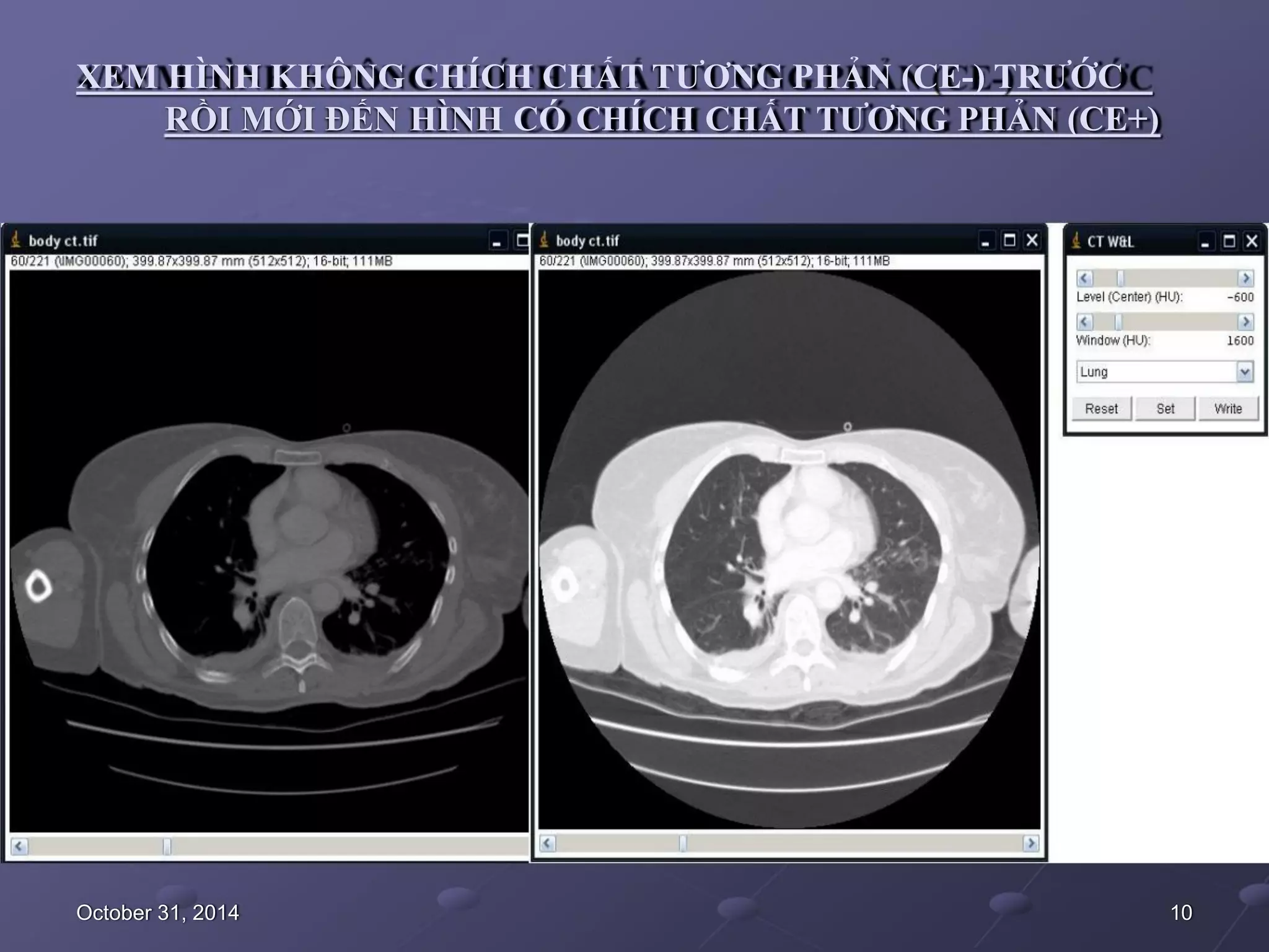 CT NGỰC - CLS HÈ 2019 (1).pdf