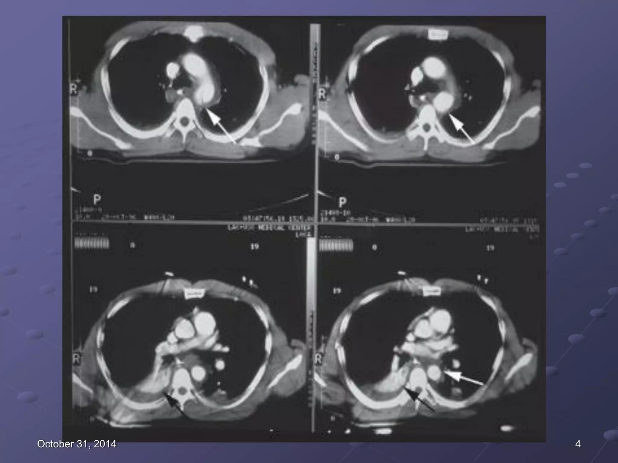 CT NGỰC - CLS HÈ 2019 (1).pdf