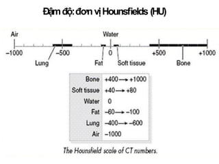 Đậmđộ:đơnvịHounsﬁelds (HU)
 