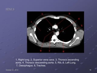 HÌNH 8
1, Right lung. 2, Superior vena cava. 3, Thoracic ascending
aorta. 4, Thoracic descending aorta. 5, Rib. 6, Left Lung.
7, Oesophagus. 8, Trachea.
October 31, 2014 19
 