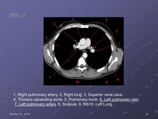 HÌNH 10
1, Right pulmonary artery. 2, Right lung. 3, Superior vena cava.
4, Thoracic ascending aorta. 5, Pulmonary trunk. 6, Left pulmonary vein.
7, Left pulmonary artery. 8, Scapula. 9, Rib10, Left Lung.
October 31, 2014 21
 