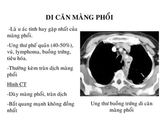 DI CAÊN MAØNG PHOÅI
-Laø u aùc tính hay gaëp nhaát cuûa
maøng phoåi.
-Ung thö pheá quaûn (40-50%),
vuù, lymphoma, buoàng tröùng,
tieâu hoùa.
-Thöôøng keøm traøn dòch maøng
phoåi
Hình CT
-Daøy maøng phoåi, traøn dòch
-Baét quang maïnh khoâng ñoàng
nhaát
Ung thö buoàng tröùng di caên
maøng phoåi
 