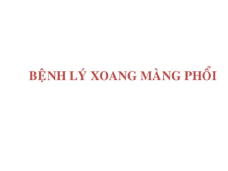BEÄNH LYÙ XOANG MAØNG PHOÅI
 