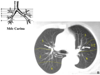 Möùc Carina
3
3
6
2
6
1/2
 