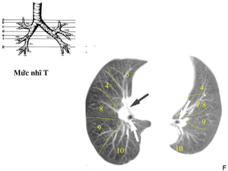 Möùc nhó T
10
5
4
8
9
10
4
7/8
9
 