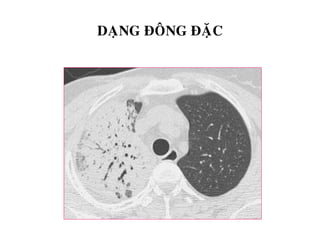 DAÏNG ÑOÂNG ÑAËC
 