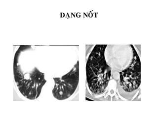 DAÏNG NOÁT
 