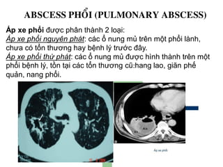 Áp xe phổi được phân thành 2 loại:
Áp xe phổi nguyên phát: các ổ nung mủ trên một phổi lành,
chưa có tổn thương hay bệnh lý trước đây.
Áp xe phổi thứ phát: các ổ nung mủ được hình thành trên một
phổi bệnh lý, tồn tại các tổn thương cũ:hang lao, giãn phế
quản, nang phổi.
ABSCESS PHOÅI (PULMONARY ABSCESS)
 