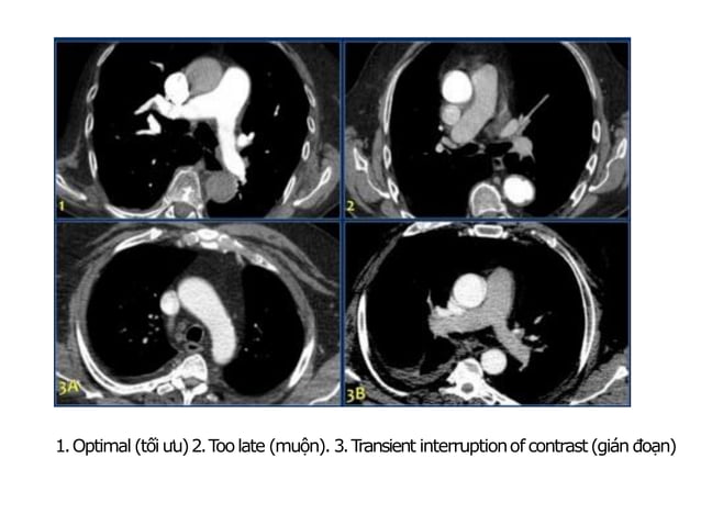 CT NGỰC - CLS HÈ 2019 (1).pdf