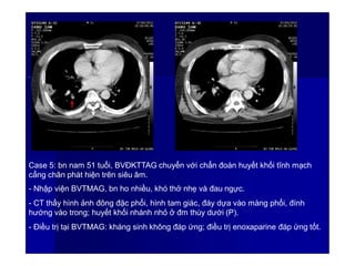 Case 5: bn nam 51 tuổi, BVĐKTTAG chuyển với chẩn đoán huyết khối tĩnh mạch
cẳng chân phát hiện trên siêu âm.
- Nhập viện BVTMAG, bn ho nhiều, khó thở nhẹ và đau ngực.
- CT thấy hình ảnh đông đặc phổi, hình tam giác, đáy dựa vào màng phổi, đính
hướng vào trong; huyết khối nhánh nhỏ ở đm thùy dưới (P).
- Điều trị tại BVTMAG: kháng sinh không đáp ứng; điều trị enoxaparine đáp ứng tốt.
61
 