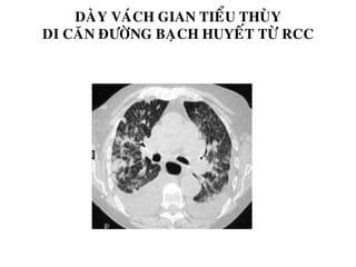 DAØY VAÙCH GIAN TIEÅU THUØY
DI CAÊN ÑÖÔØNG BAÏCH HUYEÁT TÖØ RCC
 