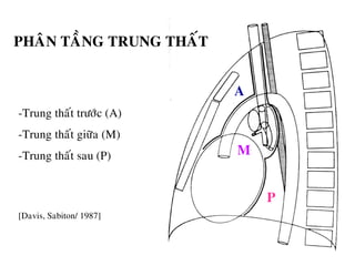 -Trung thaát tröôùc (A)
-Trung thaát giöõa (M)
-Trung thaát sau (P)
[Davis, Sabiton/ 1987]
A
M
P
PHAÂN TAÀNG TRUNG THAÁT
 