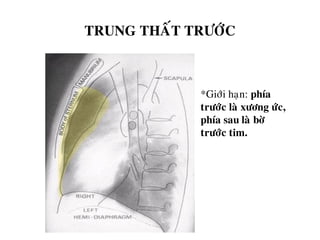 TRUNG THAÁT TRÖÔÙC
*Giôùi haïn: phía
tröôùc laø xöông öùc,
phía sau laø bôø
tröôùc tim.
 