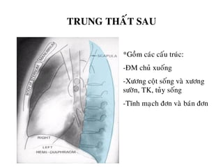 TRUNG THAÁT SAU
*Goàm caùc caáu truùc:
-ÑM chuû xuoáng
-Xöông coät soáng vaø xöông
söôøn, TK, tuûy soáng
-Tónh maïch ñôn vaø baùn ñôn
 