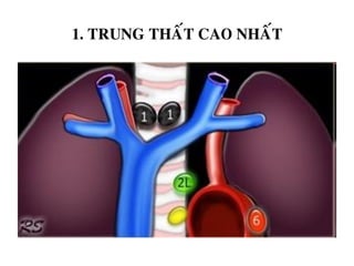 1. TRUNG THAÁT CAO NHAÁT
 