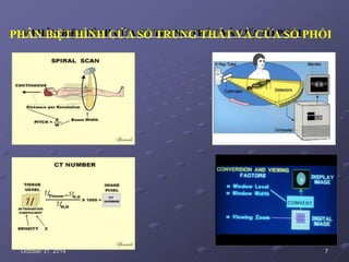 PHÂN BiỆT HÌNH CỬA SỔ TRUNG THẤT VÀ CỬA SỔ PHỔI
October 31, 2014 7
 
