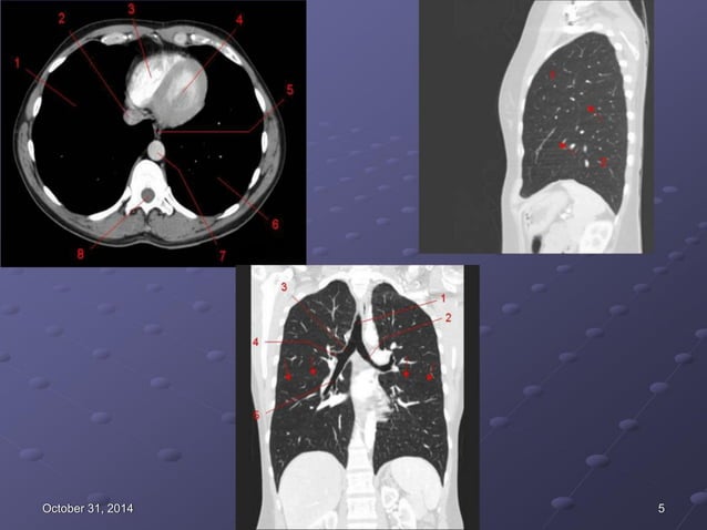 CT NGỰC - CLS HÈ 2019 (1).pdf