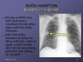 HAMPTON’S HUMP
October 31, 2014 41
 