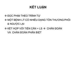  ĐỌC PHIM THEO TRÌNH TỰ
 MỘT BỆNH LÝ CÓ NHIỀU DẠNG TỔN THƯƠNG PHỔI
& NGƯỢC LẠI
 KẾT HỢP VỚI TIỀN CĂN + LS  CHẨN ĐOÁN
VÀ CHẨN ĐOÁN PHÂN BIỆT
KẾT LUẬN
 