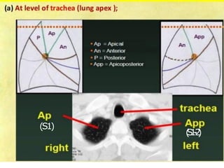 (S1)
(
S
1
-
‐
2
)
 