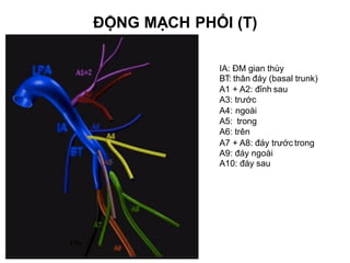 IA: ĐM gian thùy
BT: thân đáy (basal trunk)
A1 + A2: đỉnh sau
A3: trước
A4: ngoài
A5: trong
A6: trên
A7 + A8: đáy trước trong
A9: đáy ngoài
A10: đáy sau
ĐỘNG MẠCH PHỔI (T)
 