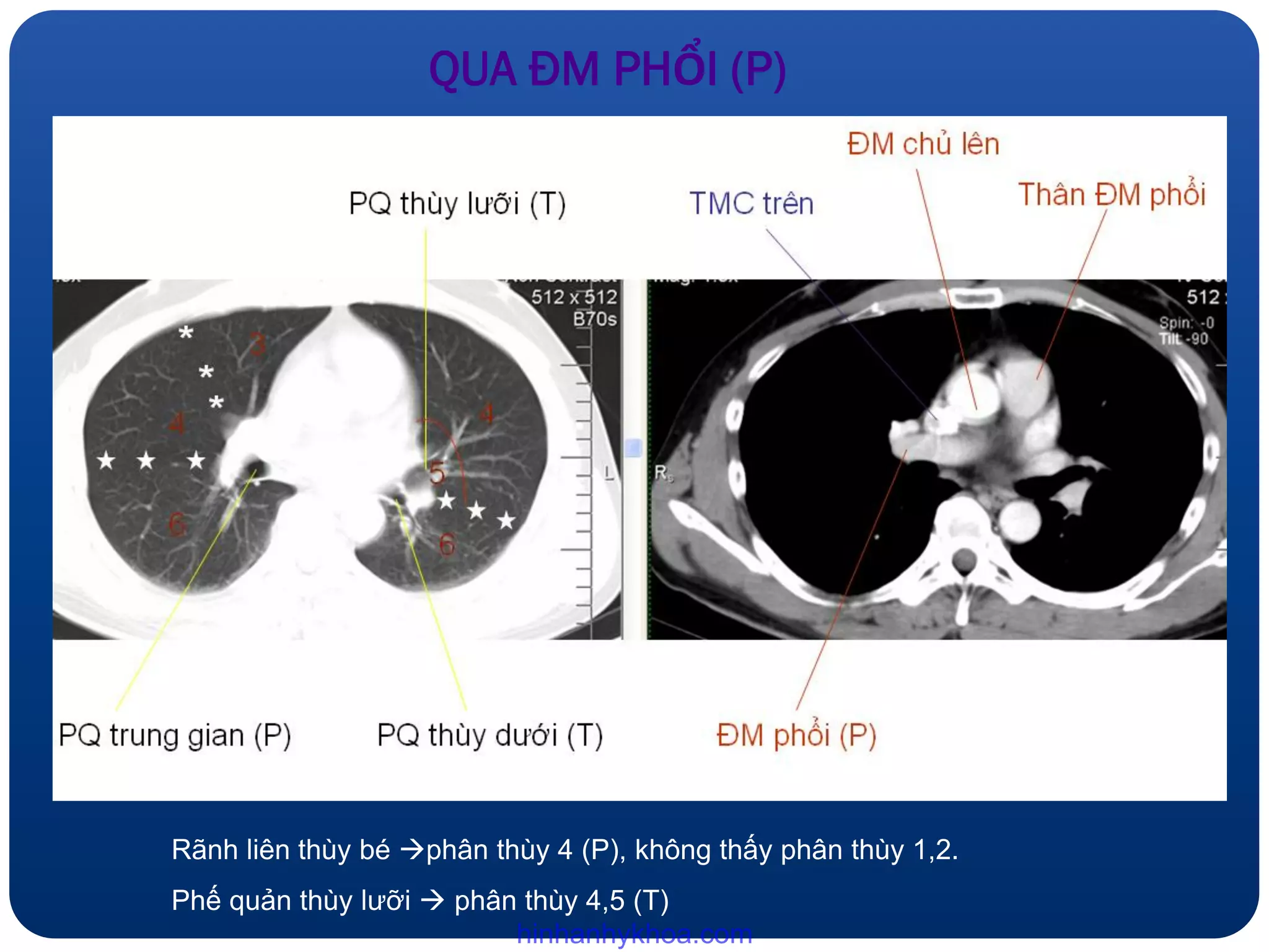 Ct nguc binh thuong, bs mai thuy (2016) | PDF