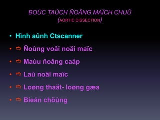 BOÙC TAÙCH ÑOÄNG MAÏCH CHUÛ
(AORTIC DISSECTION)
• Hình aûnh Ctscanner
•  Ñoùng voâi noäi maïc
•  Maùu ñoâng caáp
•  Laù noäi maïc
•  Loøng thaät- loøng gæa
•  Bieán chöùng
 