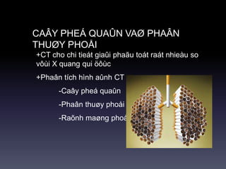 CAÂY PHEÁ QUAÛN VAØ PHAÂN
THUØY PHOÅI
+CT cho chi tieát giaûi phaãu toát raát nhieàu so
vôùi X quang qui öôùc
+Phaân tích hình aûnh CT
-Caây pheá quaûn
-Phaân thuøy phoåi
-Raõnh maøng phoåi
 