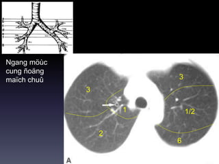 Ngang möùc
cung ñoäng
maïch chuû
3
3
2
1/21
6
 