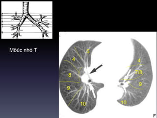 Möùc nhó T
10
5
4
8
9
10
4
7/8
9
 